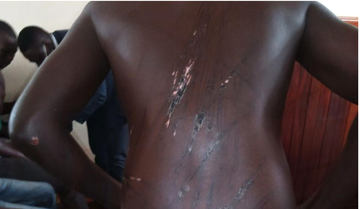 Test of Uganda’s rule of law: illegal detention, torture & extrajudicial killings